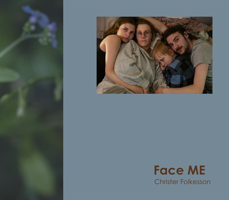 Face ME : att leva med en av världens mest funktionsnedsättande sjukdomar